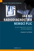 Maxdorf Jak na radiodiagnostiku nemocí plic