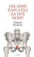 Malvern Jak jsme zaplatili za dvě nohy