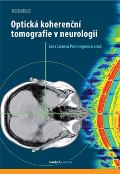 kolektiv autorů Optická koherenční tomografie v neurologii