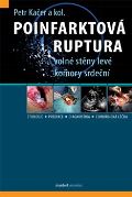 kolektiv autorů Poinfarktová ruptura volné stěny levé komory srdeční