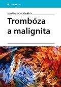 Grada Trombóza a malignita