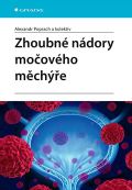 Grada Zhoubné nádory močového měchýře