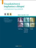 kolektiv autorů Transkatétrová implantace chlopní v instruktivních kazuistikách