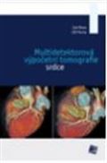 Galén Multidetektorová výpočetní tomografie srdce