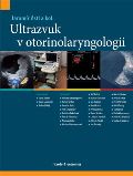 kolektiv autorů Ultrazvuk v otorinolaryngologii