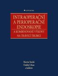 Grada Intraoperan a perioperan endoskopie a kombinovan vkony na trvic trubici