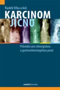 kolektiv autorů Karcinom jícnu