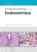 Grada Endometriza