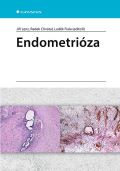 Grada Endometrióza