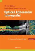 Maxdorf Optická koherenční tomografie