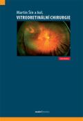Maxdorf Vitreoretinální chirurgie