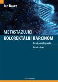 Maxdorf Metastazující kolorektální karcinom