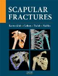 Maxdorf Scapular fractures