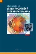 Maxdorf Věkem podmíněná degenerace makuly