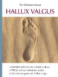 Larsen Christian Hallux valgus