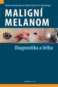 Maxdorf Maligní melanom - Diagnostika a léčba
