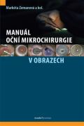 kolektiv autorů Manuál oční mikrochirurgie v obrazech