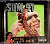 Sum 41 Does This Look Infected?