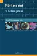 kolektiv autorů Fibrilace síní v běžné praxi