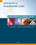 Maxdorf Arachnoid cysts - Arachnoidln cysty mozku a mchy