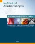 Maxdorf Arachnoid cysts - Arachnoidln cysty mozku a mchy
