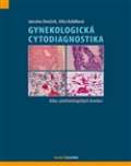 Maxdorf Gynekologick cytodiagnostika