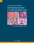 Maxdorf Gynekologická cytodiagnostika