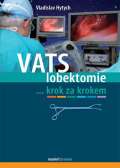Maxdorf VATS lobektomie krok za krokem