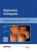 kolektiv autorů Diabetická retinopatie