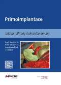 kolektiv autor Primoimplantace totln nhrady kolennho kloubu