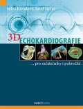 Maxdorf 3D Echokardiografie