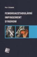 Galn Femoroacetabulrn impingement syndrom