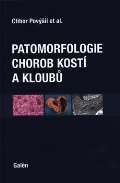 Galn Patomorfologie chorob kost a kloub