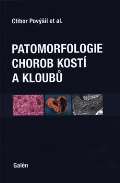 Galén Patomorfologie chorob kostí a kloubů