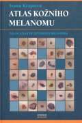 Maxdorf Atlas kožního melanomu