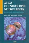 Maxdorf Atlas endoskopické neurochirurgie