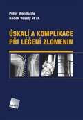 Galén Úskalí a komplikace při léčení zlomenin