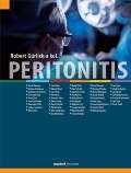 kolektiv autorů Peritonitis