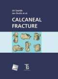 Galén Calcaneal fracture
