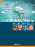 Maxdorf Funkční stereotaktická neurochirurgie