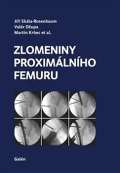 kolektiv autorů Zlomeniny proximálního femuru