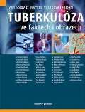 kolektiv autorů Tuberkulóza ve faktech i obrazech