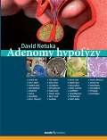 kolektiv autorů Adenomy hypofýzy